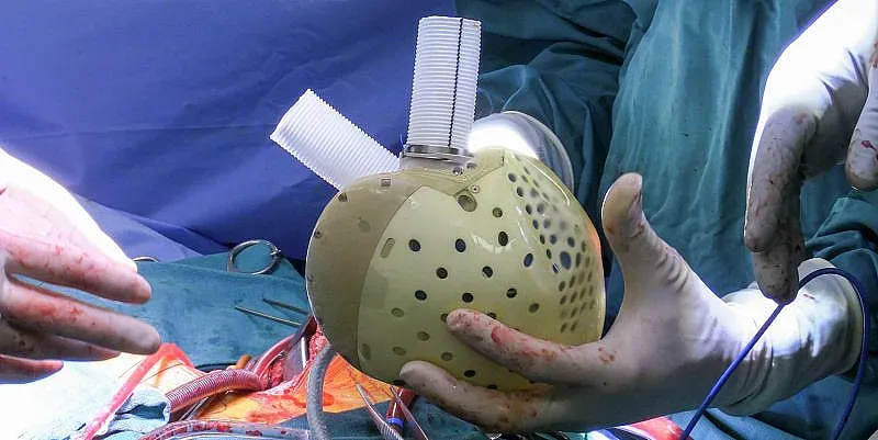 Изкуственото сърце остава мечта, кое спира важния орган