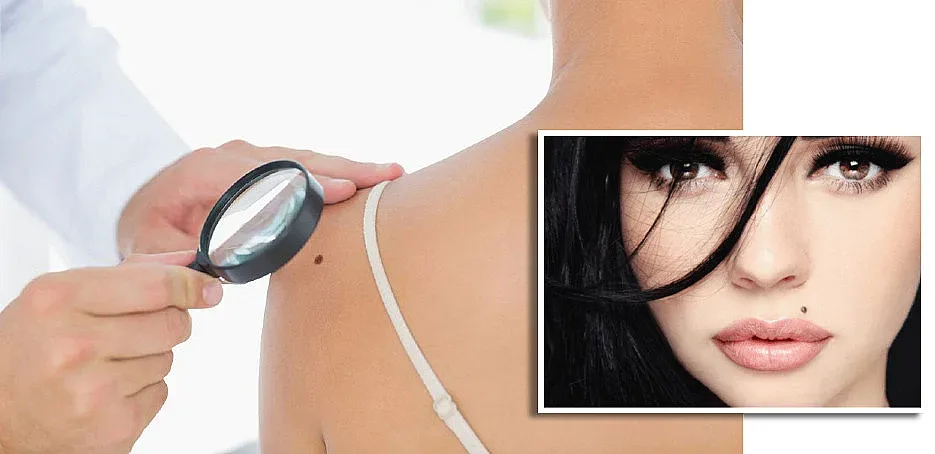 Бенката - от чар до присъда