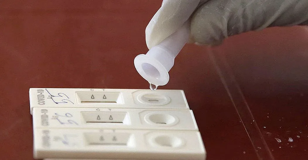 Добри новини за ковид у нас, лоши за музикалните фенове