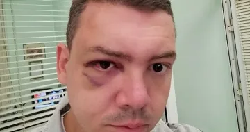 Скандал! Пребит е председател на КТ Подкрепа