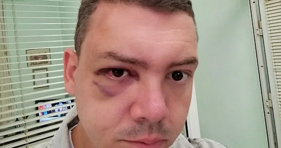 Скандал! Пребит е председател на КТ Подкрепа