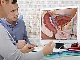 5 полезни съвета срещу рак на простата