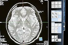 Три навика забавят стареенето на мозъка