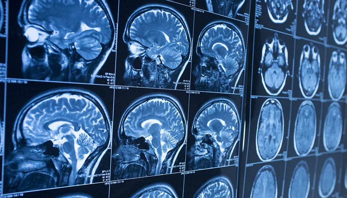 Уникално изобретение дава нов начин за изследване на човешкия мозък