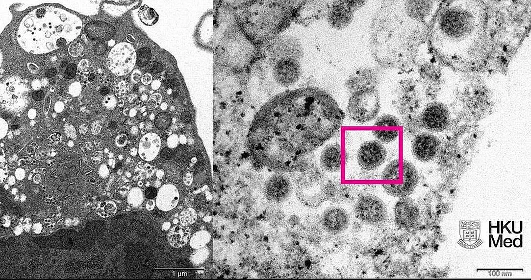 СЗО ни шашна с новите си данни за Омикрон. Пази ли ни имунитетът?