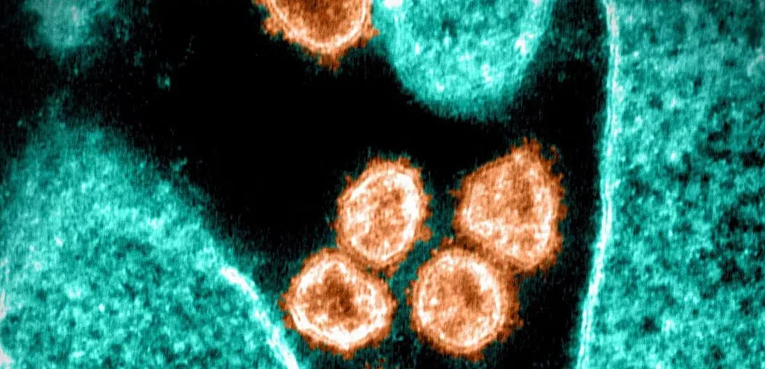 Професор каза какво ще донесе новият щам на ковид у нас