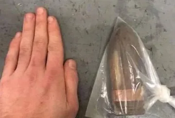 Шок! Сапьори вадят снаряд от пациент