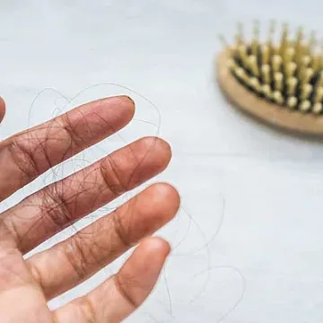 Косопадът след Ковид може да продължи над 4 месеца