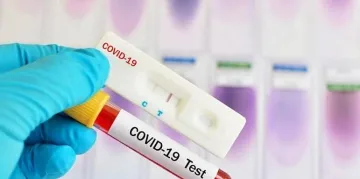 Къде да се тестваме безплатно за COVID
