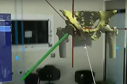 Уникална операция в болница "Лозенец"