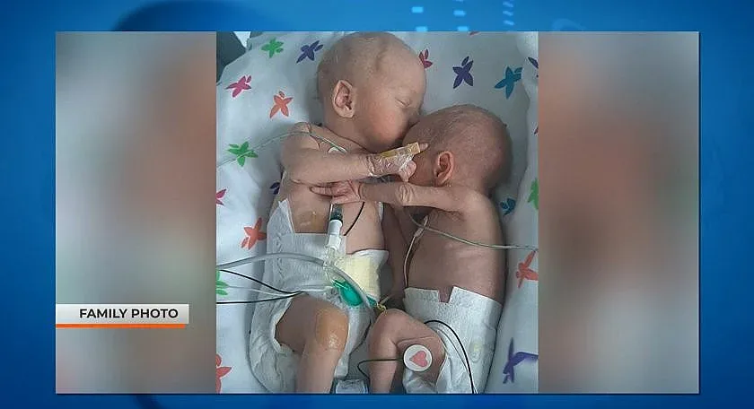 Тази прегръдка разплака света