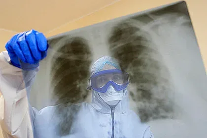 Как се възстановява белият дроб след ковид