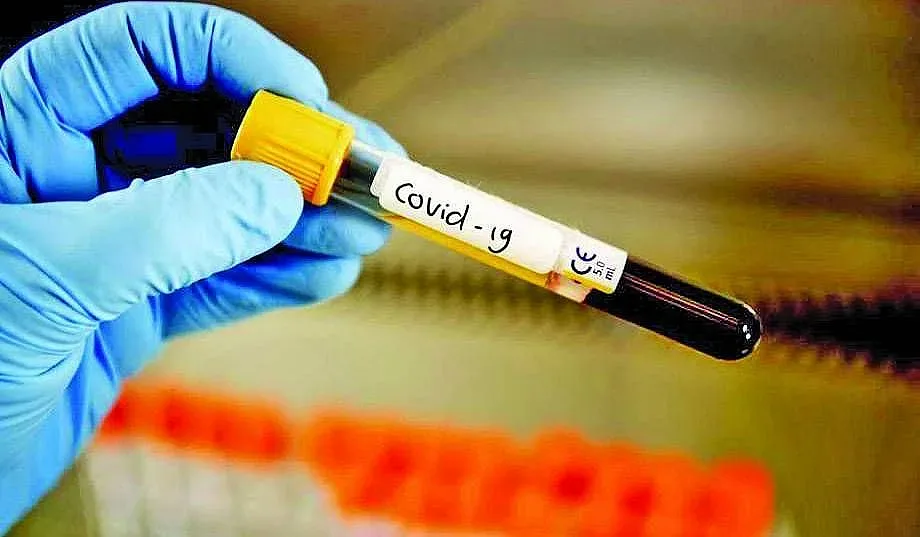 3328 заразени, 3050 излекувани