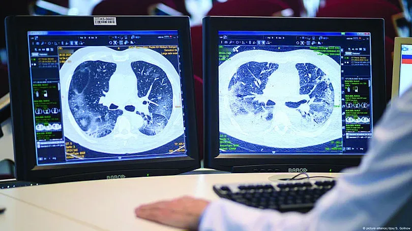 Какви "подаръци" ни остави Ковид-19