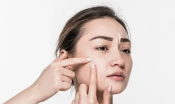 Откриха гена на акнето