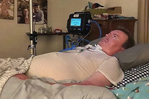 С чип от Мъск мъж се научи да управлява компютър с езика си