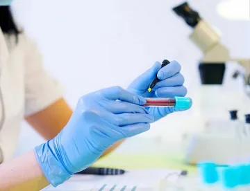 Тест хваща рак 4 години преди симптомите