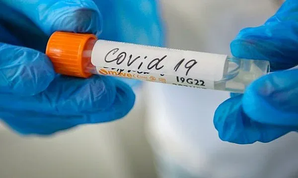 Заразата набира скорост в Хонконг