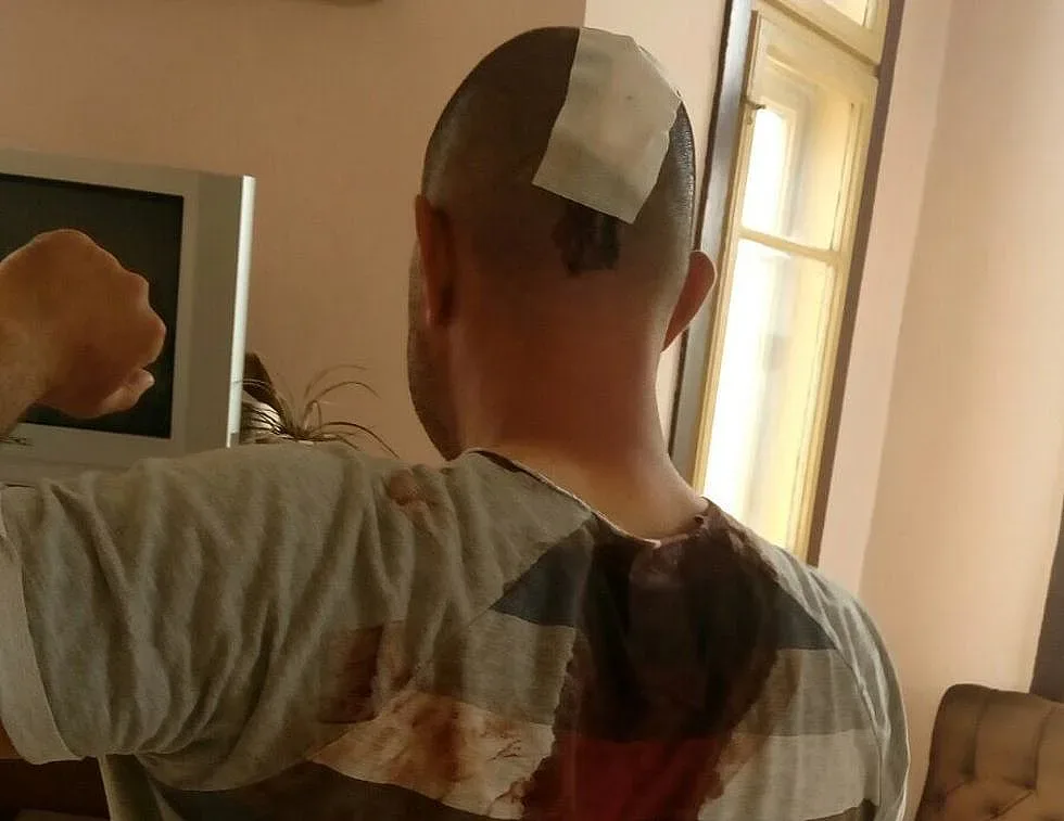 Вижте битите със секира полицаи