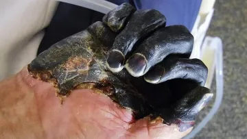 Ново 20: Съмнение за бубонна чума в Китай