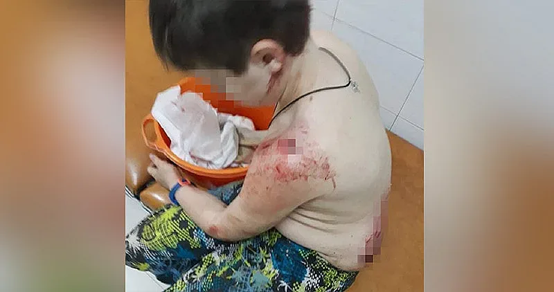 10-годишно дете нахапано жестоко от кане корсо