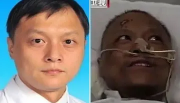 Какво се случи с кожата на оздравели от COVID-19