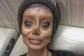 Иранската Анджелина Джоли заразена в затвора