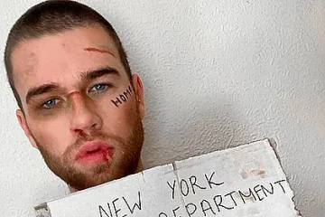 Нова мода: Селфи с белези по лицето