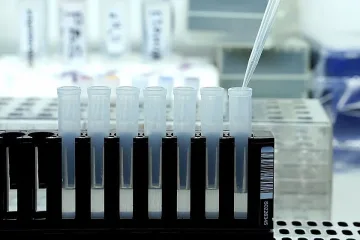 Прокуратурата проверява бързи тестове за COVID-19