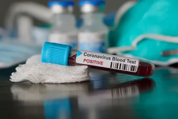 Трима са вече излекуваните у нас