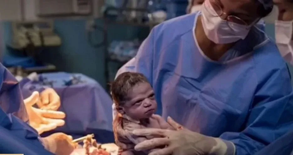 Изродиха най-намръщеното бебе