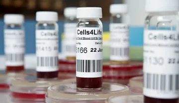 Заблудата за стволови клетки с метода TotyCyte на Cells4life