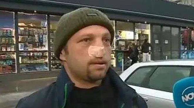 Побойник отхапа носа на шофьор и избяга