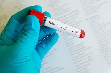 Хепатит А сред деца в Симеоновград