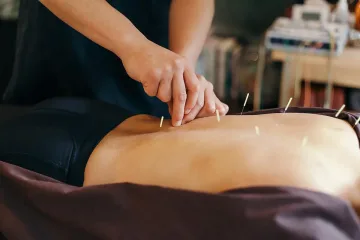 Когато иглите лекуват