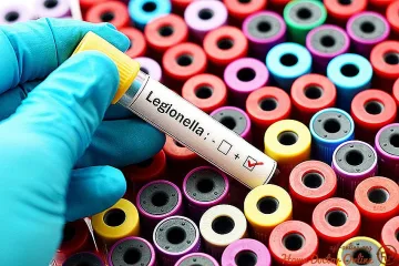 Бактерията на легионелозата  се предава през климатика