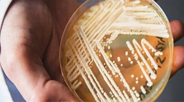 Открита в Япония гъбичка сее смърт в Европа и САЩ