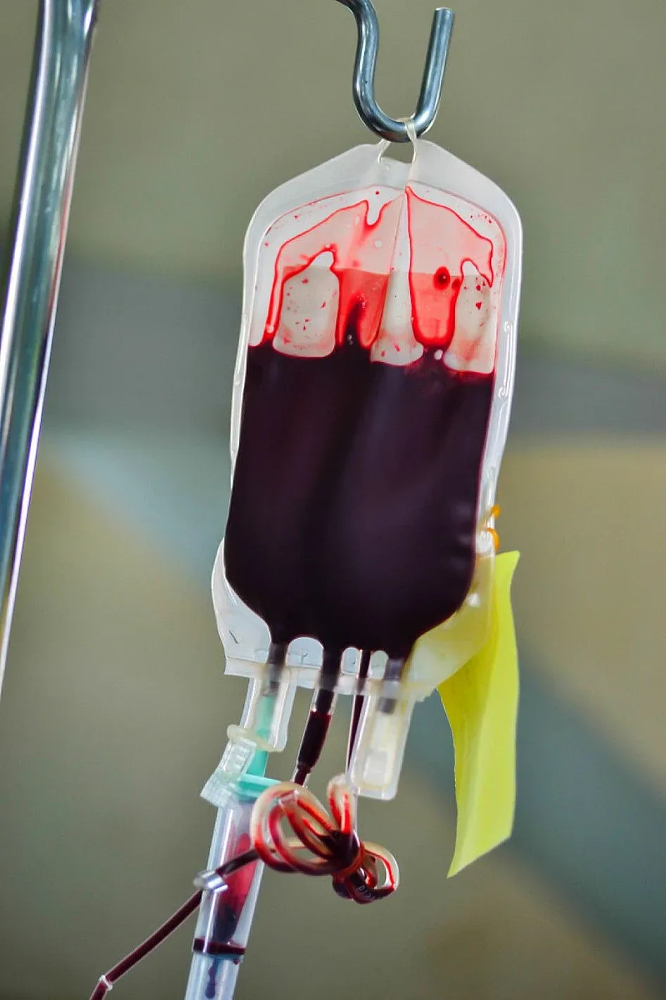 Цената за сакче кръв на черно стигна 600 лева