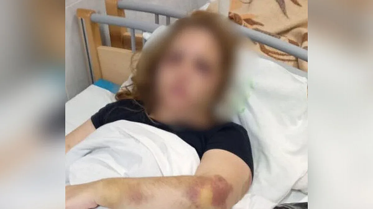 Цял град е в ужас! Гадже преби жестоко млада жена с две деца