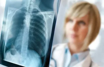 Странният случай  на детето куче