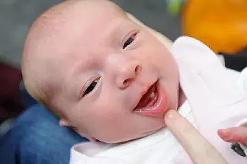Бебе във Великобритания се роди с млечен зъб