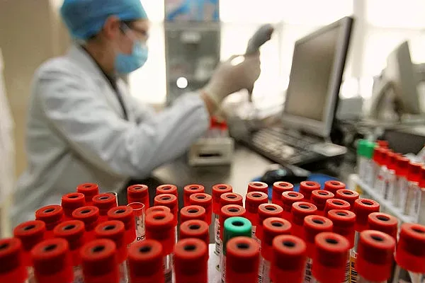 Повече нови случаи на ХИВ в Източна Европа