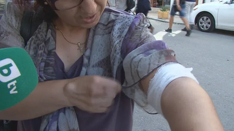 Агресивен ротвайлер нахапа жена в центъра на Бургас