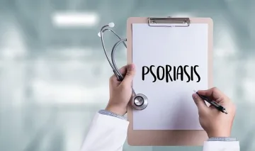 Преразглеждат решение, затрудняващо достъпа до биологично лечение на псориазис