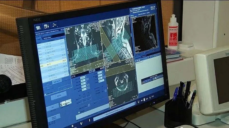 Вече и в България: Изследване за 300 лв. открива бързо рак на гърдата