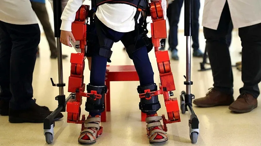 Финансират изкуствен скелет за сакати деца