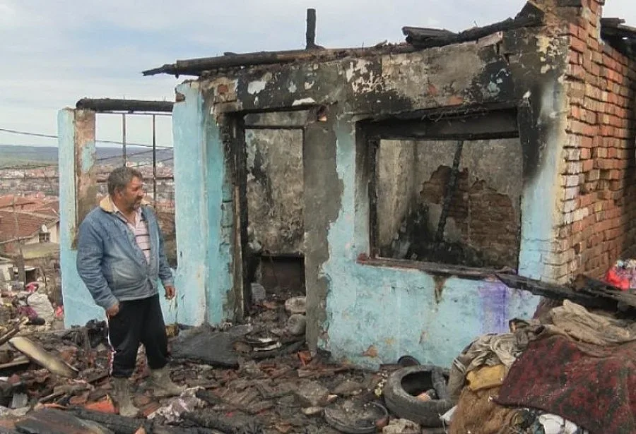 Едното от пострадалите при пожара в Средец деца е с 85% изгаряния