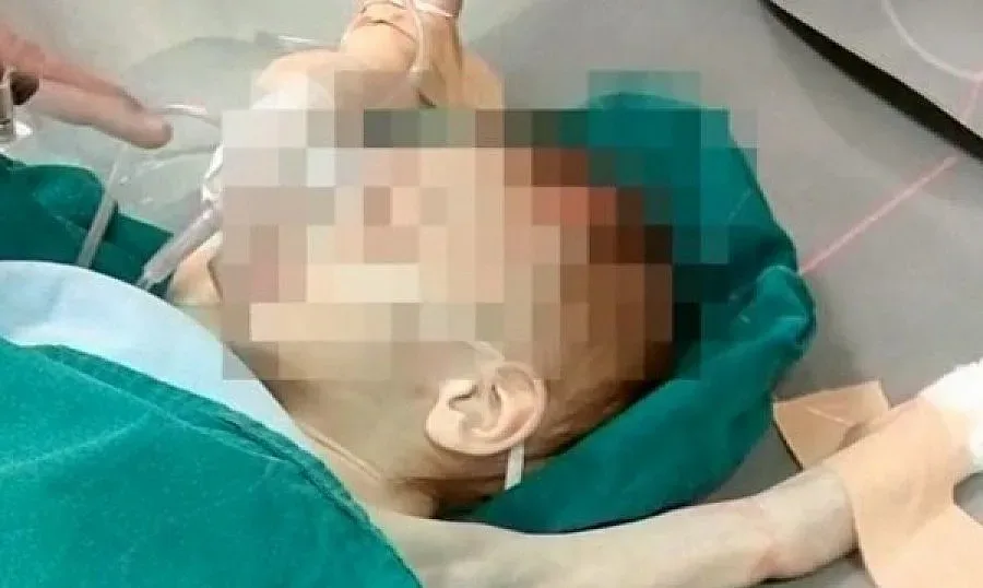 Освободиха майката на недохранените близнаци, приети в болница