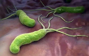 Как хеликобактер пилори причинява рак на стомаха