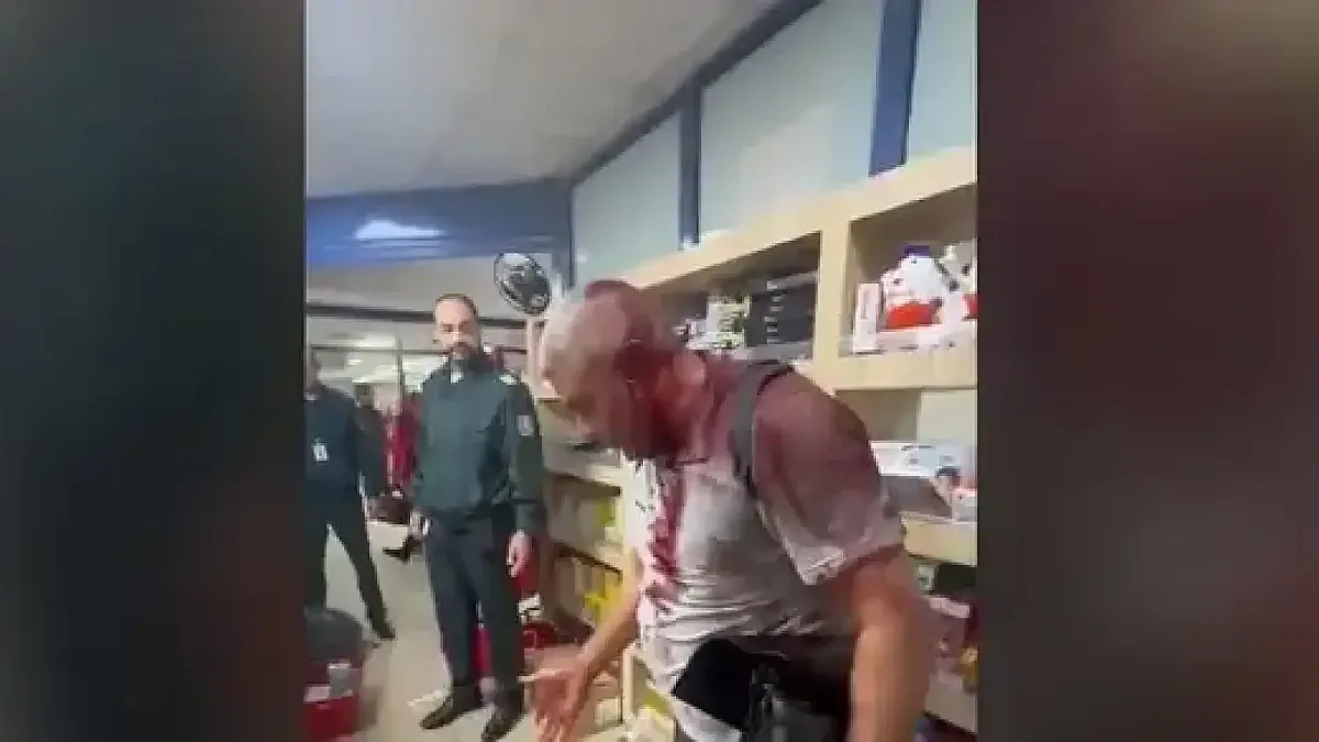 Удивителна причина за кървавия бой на летището